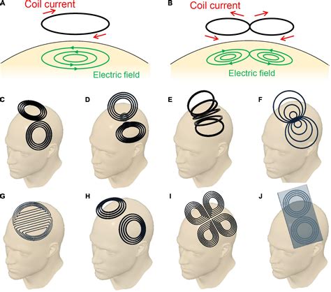 Frontiers Figure Eight Coils For Magnetic Stimulation From Focal