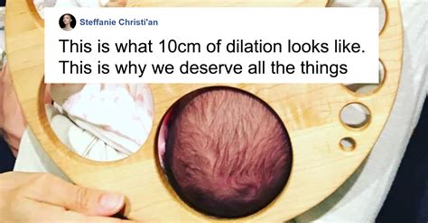 This Dilation Chart Shows What A Womans Body Has To Go Through