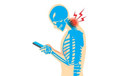 Text Neck Heres What Texting Is Doing To Your Neck And How To Fix It