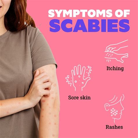 scabies prevention