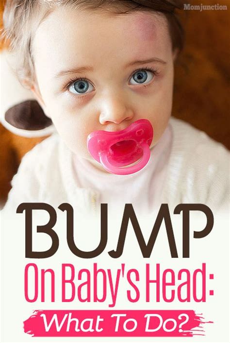 What To Do When Your Baby Gets A Bump On The Head Baby Bumped Head