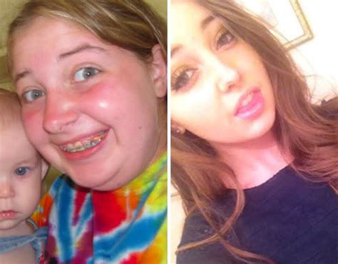 20 People Share Their Incredible ‘ugly Duckling