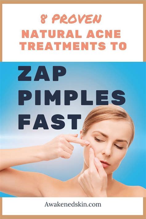 Zap Pimples Fast Acne Treatments Natural Acne Treatments Skin Care