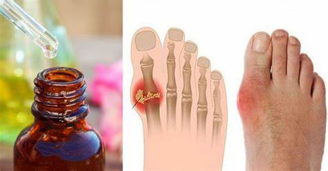 Диета для жирных пальцев Диета При Артрите Пальцев Рук — Похудение Диета Правильное Питание Диета При Артрите Пальцев Рук — Похудение Диета Правильное Питание Диета для жирных пальцев