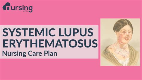 Nursing Care Plan For Systemic Lupus Erythematosus Nursing Care Plan