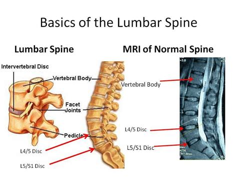 Image Result For Lower Lumbar Facet Health Care And Medical