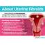 Uterine Fibroids  SheCares