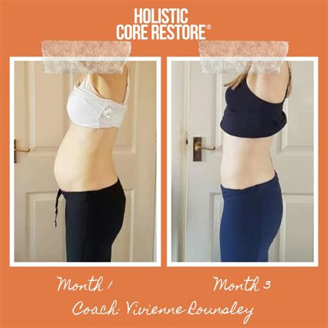 Before After Diastasis Recti Repair Gallery Holistic Core Restore