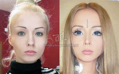The Real Face Of Human Barbie Dolls Before And After Photos
