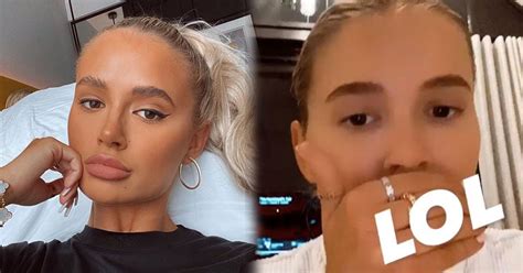Molly Mae Hague Teases Natural Lips As She Has Fillers Completely