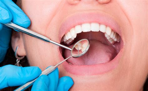 Alveolitis Dental Causas Y Prevención Clínica Cristina Viyuela Co