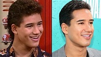 Mario Lopez before and after plastic surgery (10) | Celebrity plastic ...