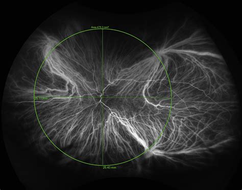 Classification And Guidelines For Widefield Imaging Ophthalmology Retina