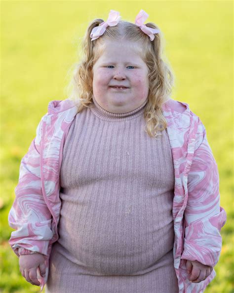 Desperate Mother Locks Kitchen To Curb Obesity In 5 Year Old Daughter