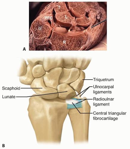 Arthroscopic And Open Triangular Fibrocartilage Complex Repair