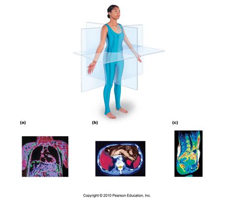 Body Planes And Sections Diagram Quizlet