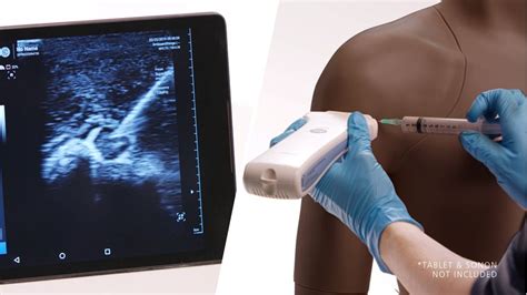 Shoulder Injection Trainer Ultrasound Guided