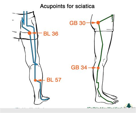 The Sciatic Nerve What It Is And How To Relieve Pain Brandon Orthopedics