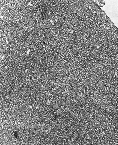 Photograph Smooth Endoplasmic Reticulum Tem Science Source Images