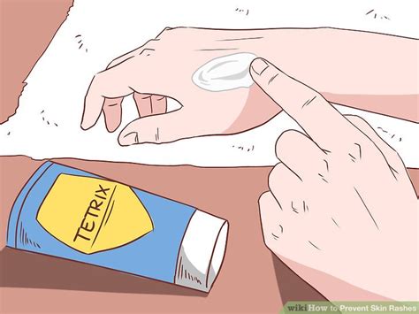 5 Ways To Prevent Skin Rashes Wikihow