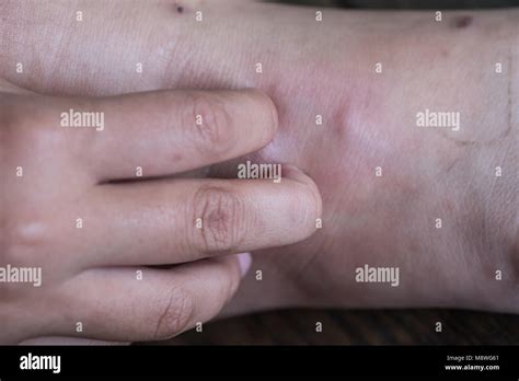 Podiatrist Diabetic Hi Res Stock Photography And Images Alamy