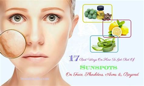 17 Best Ways How To Get Rid Of Sunspots On Face Shoulders And Arms