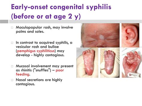 Ppt Pengendalian Bayi Dari Ibu Sifilis Powerpoint Presentation Free