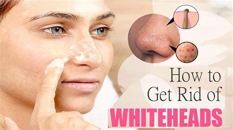 Skincare Routine For Whiteheads Beauty And Health