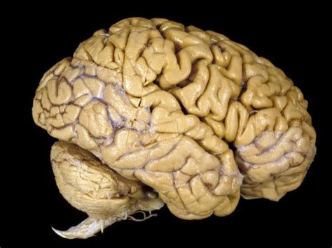 Heres How The Brain Evolved Clamor World