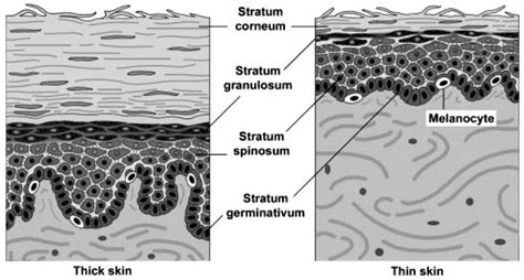 Thick And Thin Skin Structure 14 Download Scientific Diagram