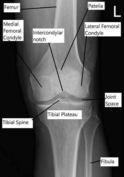Knee Anatomy Complete Orthopedics Multiple Ny Locations