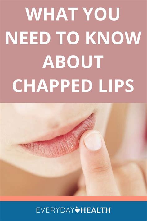 Chapped Lips Causes Treatments And Prevention Everyday Health