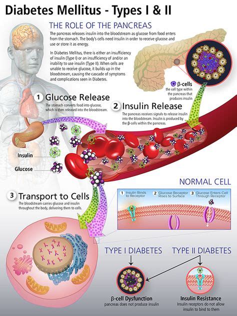 Diabetes Mellitus On Behance Systems Endocrine Diabetes Nursing