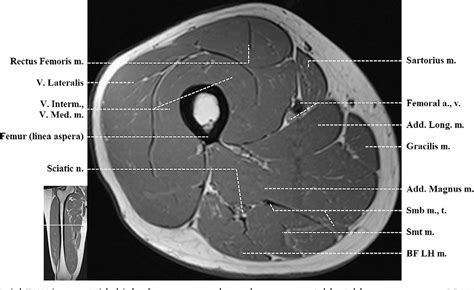 As the cursor is moved over a particular compartment of the lower. Figure 3 from Normal MR imaging anatomy of the thigh and ...