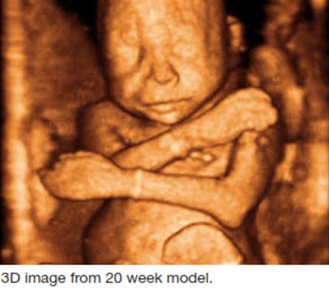 Full Fetal Phantom 20 Weeks Gestation Csp Medical
