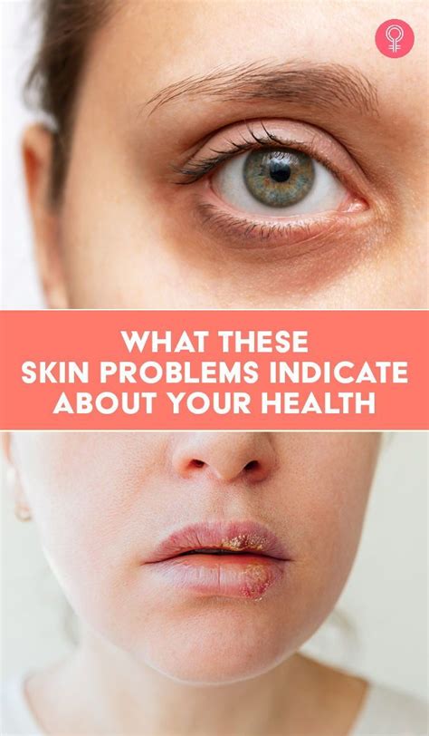 What 11 Facial Skin Defects Are Trying To Tell You About Your Health