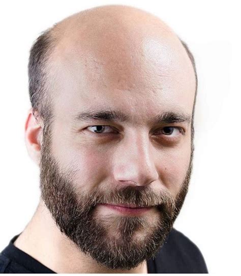 pin by antonio sanchez on calvos bald men with beards male pattern baldness bald with beard