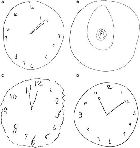 Clock Drawing Test To Diagnose Alzheimers Sisters Hospitallers Cio