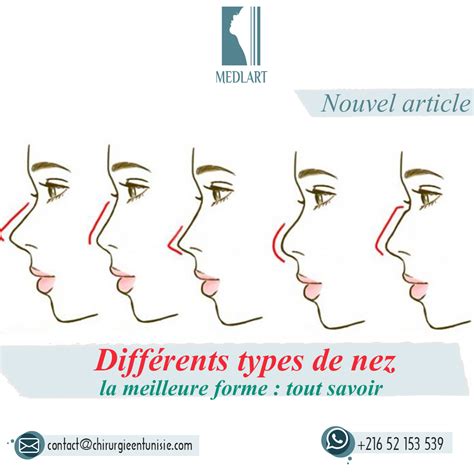 Différents types de nez et la meilleure correction de chaque défaut