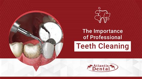 The Importance Of Professional Teeth Cleaning Dental Blogs