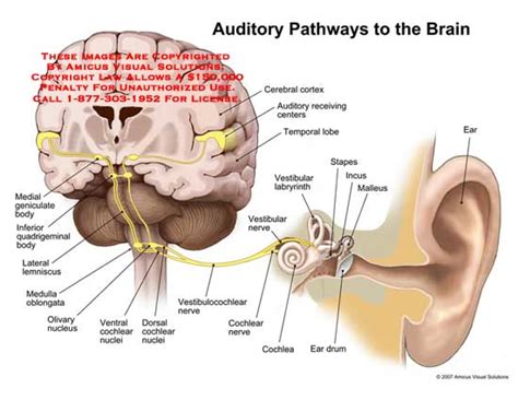 AMICUS Illustration Of Amicus Medical Brain Auditory Pathways Geniculate Body Quadrigeminal