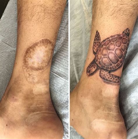 Clever Tattoo Designs That Turn Scars Into Beautiful Works