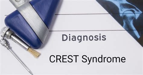 Characteristics And Causes Of Crest Syndrome Facty Health