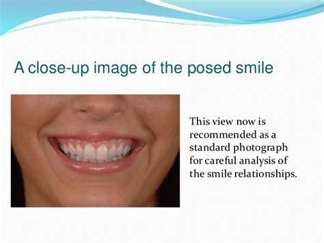 Clinical Digital Photography In Orthodontics