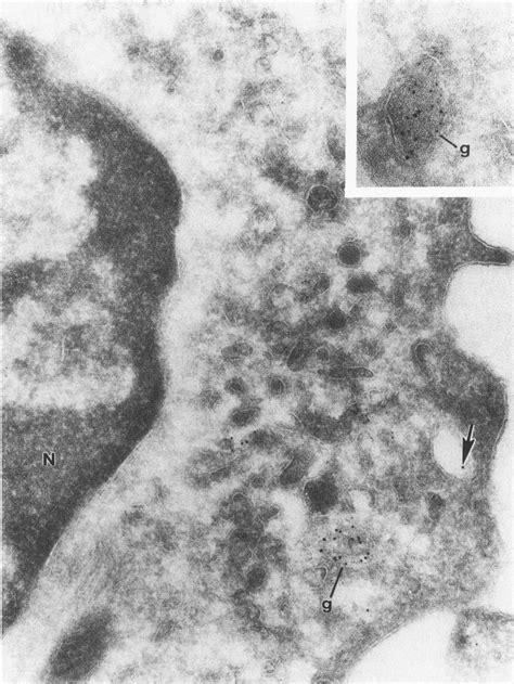 A Portion Of A Normal Human Monocyte Which Has Been Double Labeled For