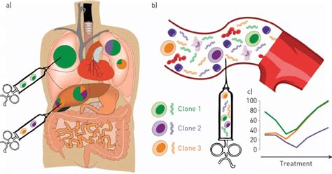 Liquid Biopsy Compared To Tissue Biopsy Can Capture Both Spatial A