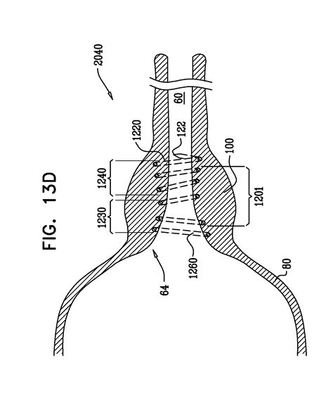 Patent Us20100130815 Intraurethral And Extraurethral Apparatus
