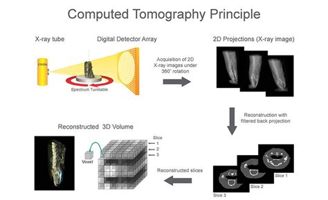 Basic Principle Of Ct Scan Ct Scan Machine