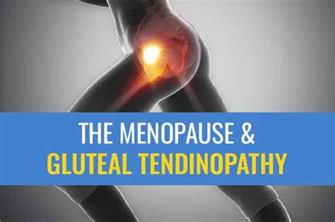 How The Menopause Can Predispose You To Gluteal Tendinopathy