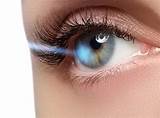 Images of Lasik Eye Surgery Advantages